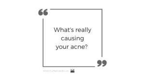 What's Really Causing Your Acne!