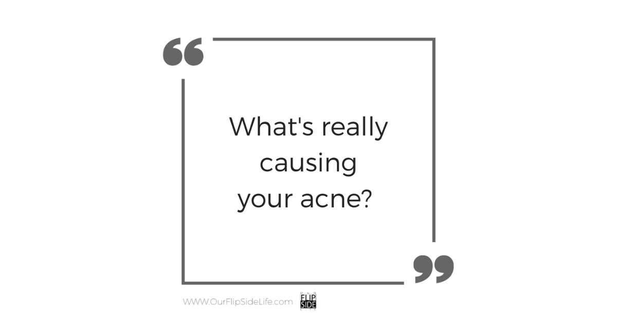 What's Really Causing Your Acne!